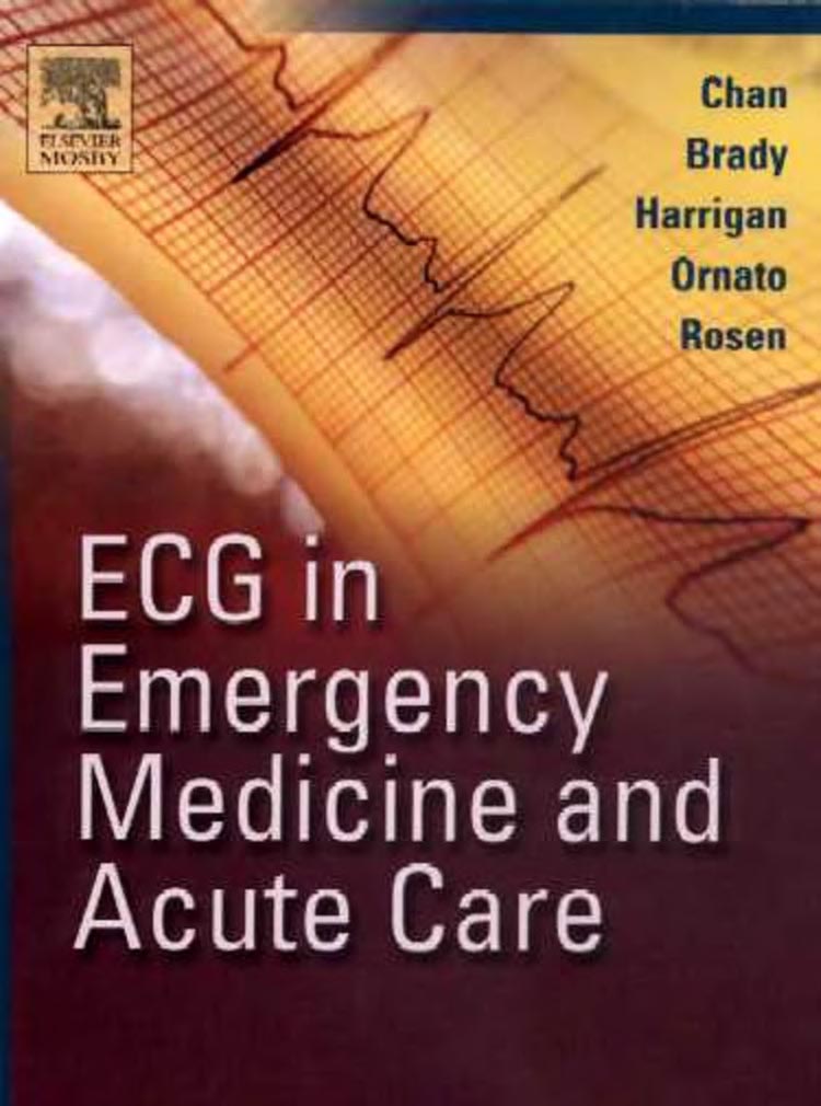 ECG in Emergency Medicine and Acute Care 1e 2005